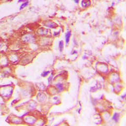 Anti-Insulin Receptor beta (phospho Tyr1316) antibody used in IHC (Paraffin sections) (IHC-P). GTX55014