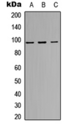 Anti-Insulin Receptor beta (phospho Tyr1316) antibody used in Western Blot (WB). GTX55014