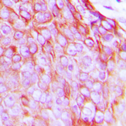 Anti-Insulin Receptor beta (phospho Tyr1322) antibody used in IHC (Paraffin sections) (IHC-P). GTX55015