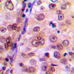 Anti-p38 MAPK (phospho Tyr323) antibody used in IHC (Paraffin sections) (IHC-P). GTX55020