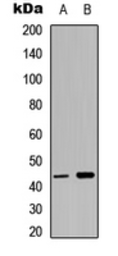 Anti-p38 MAPK (phospho Tyr323) antibody used in Western Blot (WB). GTX55020