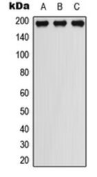 Anti-PDGF Receptor beta (phospho Tyr751) antibody used in Western Blot (WB). GTX55024