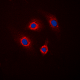 Anti-DARPP-32 (phospho Thr34) antibody used in Immunocytochemistry/ Immunofluorescence (ICC/IF). GTX55025