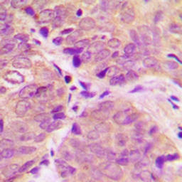 Anti-DARPP-32 (phospho Thr34) antibody used in IHC (Paraffin sections) (IHC-P). GTX55025