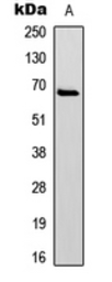 Anti-Paxillin (phospho Tyr31) antibody used in Western Blot (WB). GTX55026