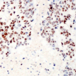 Anti-ATF2 (phospho Ser62) antibody used in IHC (Paraffin sections) (IHC-P). GTX55045