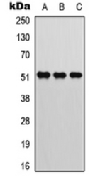 Anti-ATF2 (phospho Thr73) antibody used in Western Blot (WB). GTX55047