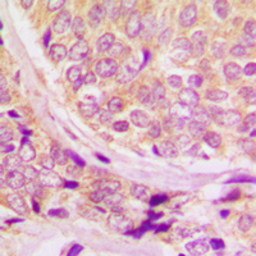 Anti-Cyclin B1 (phospho Ser147) antibody used in IHC (Paraffin sections) (IHC-P). GTX55051