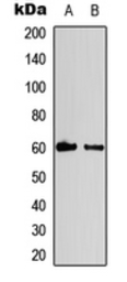 Anti-Cyclin B1 (phospho Ser147) antibody used in Western Blot (WB). GTX55051