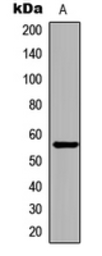 Anti-Chk1 (phospho Ser296) antibody used in Western Blot (WB). GTX55053