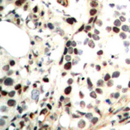 Anti-Chk2 (phospho Thr68) antibody used in IHC (Paraffin sections) (IHC-P). GTX55055