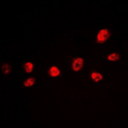 Anti-CREB (phospho Ser142) antibody used in Immunocytochemistry/ Immunofluorescence (ICC/IF). GTX55056