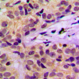 Anti-CBL (phospho Tyr674) antibody used in IHC (Paraffin sections) (IHC-P). GTX55083