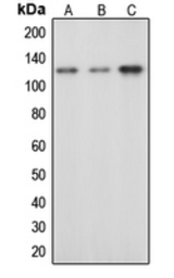 Anti-CBL (phospho Tyr674) antibody used in Western Blot (WB). GTX55083