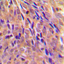 Anti-IKK alpha (phospho Thr23) antibody used in IHC (Paraffin sections) (IHC-P). GTX55094