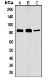 Anti-IKK alpha (phospho Thr23) antibody used in Western Blot (WB). GTX55094