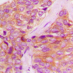 Anti-JAK1 (phospho Tyr1022) antibody used in IHC (Paraffin sections) (IHC-P). GTX55099