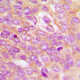 Anti-IKK beta (phospho Tyr199) antibody used in IHC (Paraffin sections) (IHC-P). GTX55109