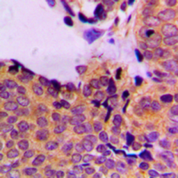 Anti-PDPK1 / PDK1 (phospho Ser241) antibody used in IHC (Paraffin sections) (IHC-P). GTX55111