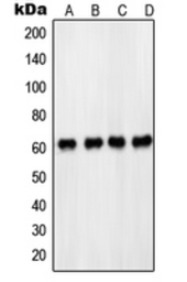 Anti-PDPK1 / PDK1 (phospho Ser241) antibody used in Western Blot (WB). GTX55111