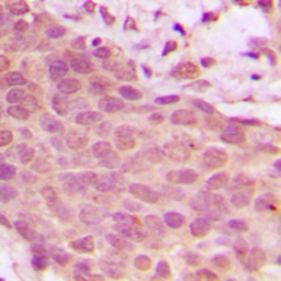 Anti-NFkB p65 (phospho Ser536) antibody used in IHC (Paraffin sections) (IHC-P). GTX55114