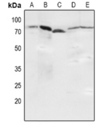 Anti-NFkB p65 (phospho Ser536) antibody used in Western Blot (WB). GTX55114