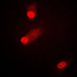 Anti-SEK1 / MKK4 (phospho Ser80) antibody used in Immunocytochemistry/ Immunofluorescence (ICC/IF). GTX55115