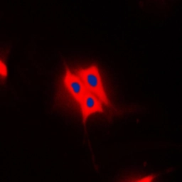 Anti-AS160 / TBC1D4 (phospho Thr642) antibody used in Immunocytochemistry/ Immunofluorescence (ICC/IF). GTX55118