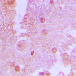 Anti-AS160 / TBC1D4 (phospho Thr642) antibody used in IHC (Paraffin sections) (IHC-P). GTX55118