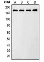 Anti-AS160 / TBC1D4 (phospho Thr642) antibody used in Western Blot (WB). GTX55118