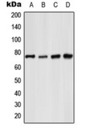 Anti-NFkB p65 (phospho Ser529) antibody used in Western Blot (WB). GTX55128