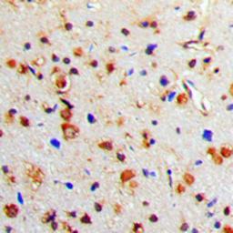 Anti-Tyrosine Hydroxylase (phospho Ser40) antibody used in IHC (Paraffin sections) (IHC-P). GTX55129