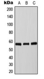 Anti-Tyrosine Hydroxylase (phospho Ser40) antibody used in Western Blot (WB). GTX55129