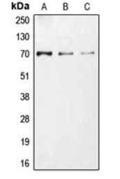 Anti-CDC25A (phospho Ser76) antibody used in Western Blot (WB). GTX55131