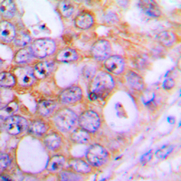Anti-CHML antibody used in IHC (Paraffin sections) (IHC-P). GTX55138