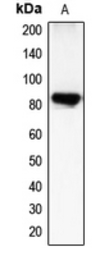 Anti-CHML antibody used in Western Blot (WB). GTX55138
