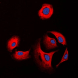 Anti-COL11A1 antibody used in Immunocytochemistry/ Immunofluorescence (ICC/IF). GTX55142