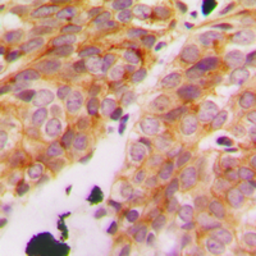 Anti-COL11A1 antibody used in IHC (Paraffin sections) (IHC-P). GTX55142