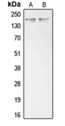 Anti-COL11A1 antibody used in Western Blot (WB). GTX55142