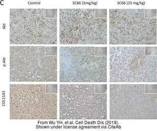 Anti-COL11A1 antibody used in IHC (Paraffin sections) (IHC-P). GTX55142