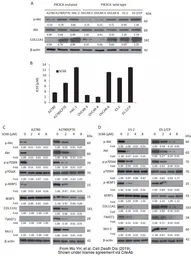 Anti-COL11A1 antibody used in Western Blot (WB). GTX55142