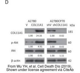 Anti-COL11A1 antibody used in Western Blot (WB). GTX55142