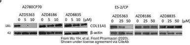 Anti-COL11A1 antibody used in Western Blot (WB). GTX55142