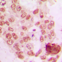 Anti-GRK5 antibody used in IHC (Paraffin sections) (IHC-P). GTX55150