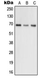 Anti-GRK5 antibody used in Western Blot (WB). GTX55150