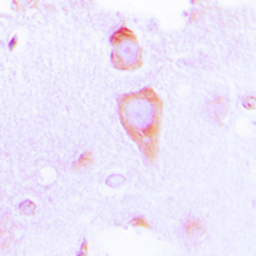 Anti-GUCY1B3 antibody used in IHC (Paraffin sections) (IHC-P). GTX55151
