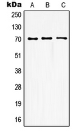 Anti-GUCY1B3 antibody used in Western Blot (WB). GTX55151