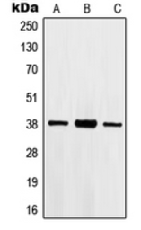 Anti-HOXB2 antibody used in Western Blot (WB). GTX55152
