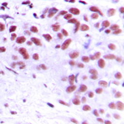Anti-MEOX2 antibody used in IHC (Paraffin sections) (IHC-P). GTX55157