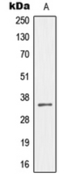 Anti-MEOX2 antibody used in Western Blot (WB). GTX55157